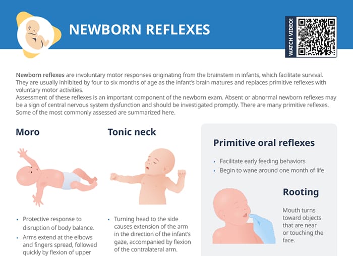 Mastering Baby Reflexes: Your AP Psychology Exam Cheat Sheet