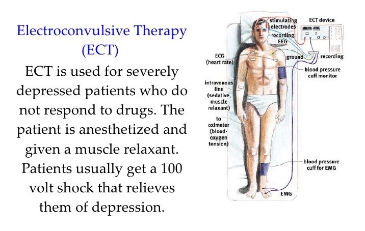 Learn Electroconvulsive Therapy AP Psychology Definition (Get The Key Concepts Now)